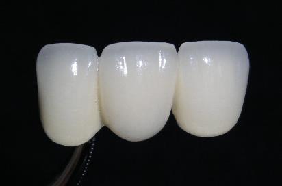 Allianza Titanium